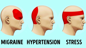 Illustration : "6 façons de vous débarrasser de votre mal de tête en 5 minutes et sans comprimés"
