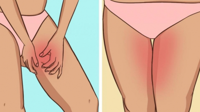 Illustration : En été, évitez les irritations aux jambes avec ces 7 astuces ! 