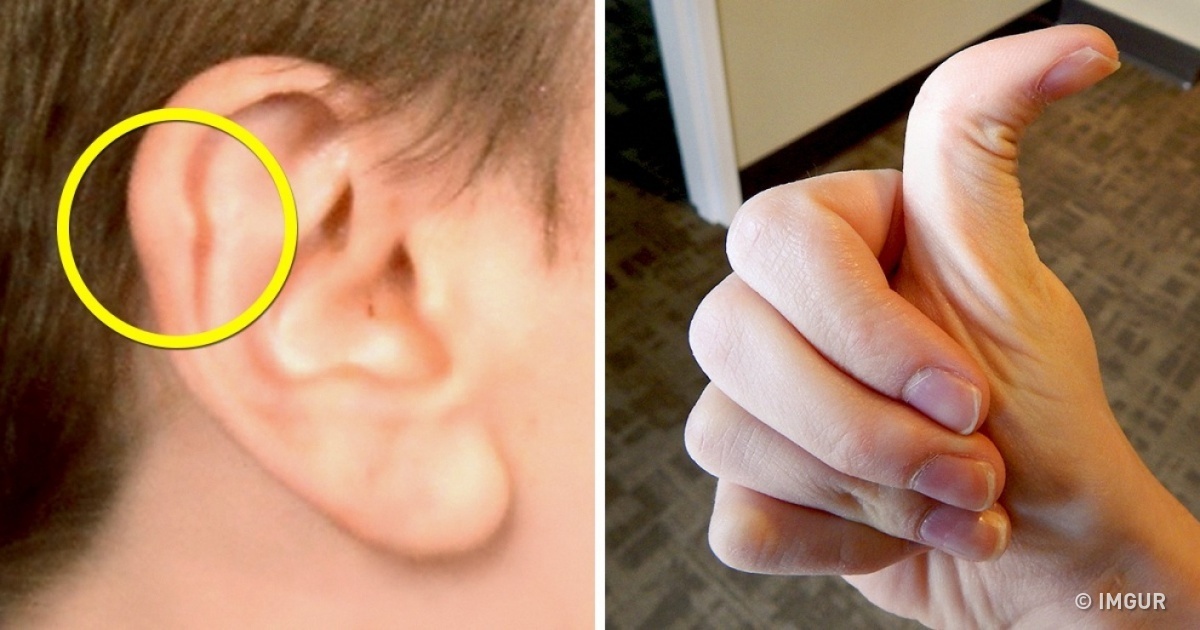 11 Details Sur Votre Corps Qui Prouvent Que Vous Etes Unique