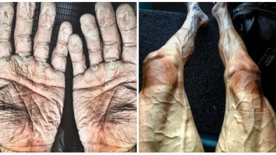 Illustration : Ces 14 personnes ont dépassé leurs limites, grâce à un mental d’acier