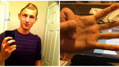 Illustration : Ces 18 personnes sont uniques grâce à leurs particularités physiques