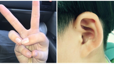 Illustration : Ces 17 particularités physiques de ces personnes à découvrir