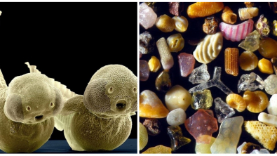 Illustration : Ces 20 photos de choses prises au microscope