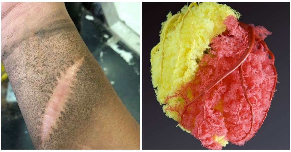 Ces 15 photos qui en disent beaucoup sur le corps humain