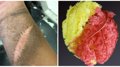 Illustration : Ces 15 photos qui en disent beaucoup sur le corps humain