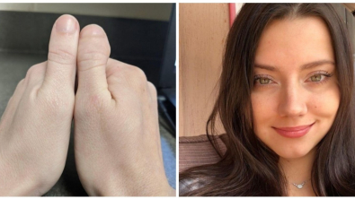 Illustration : Ces 20 personnes nées avec des particularités offertes par la nature