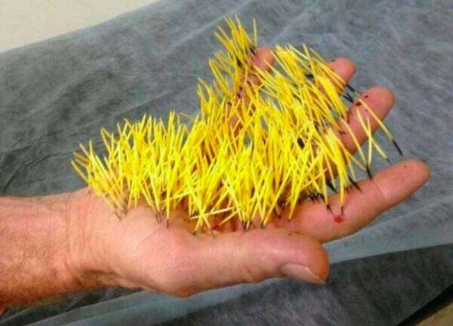 Illustration de l'article : 23 des pires décisions que l’on puisse prendre dans sa vie