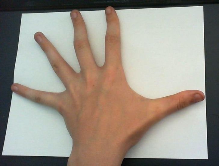 Illustration de l'article : Ces 20 personnes nées avec des particularités offertes par la nature