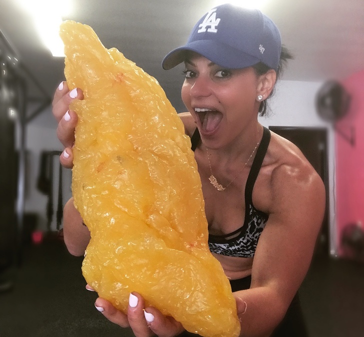 Illustration de l'article : Ces 15 photos qui en disent beaucoup sur le corps humain