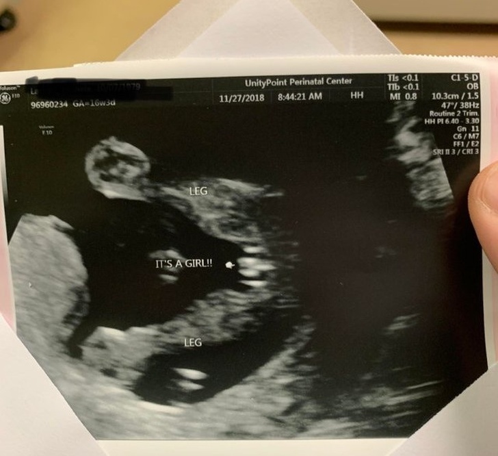 Illustration de l'article : Ces 19 photos qui transmettent la joie de vivre