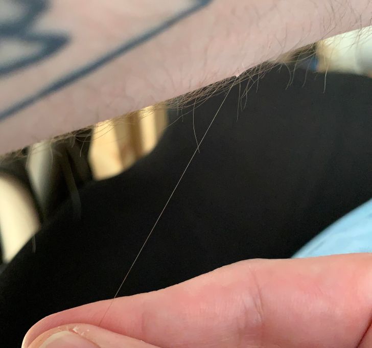 Illustration de l'article : Ces 20 personnes nées avec des particularités offertes par la nature