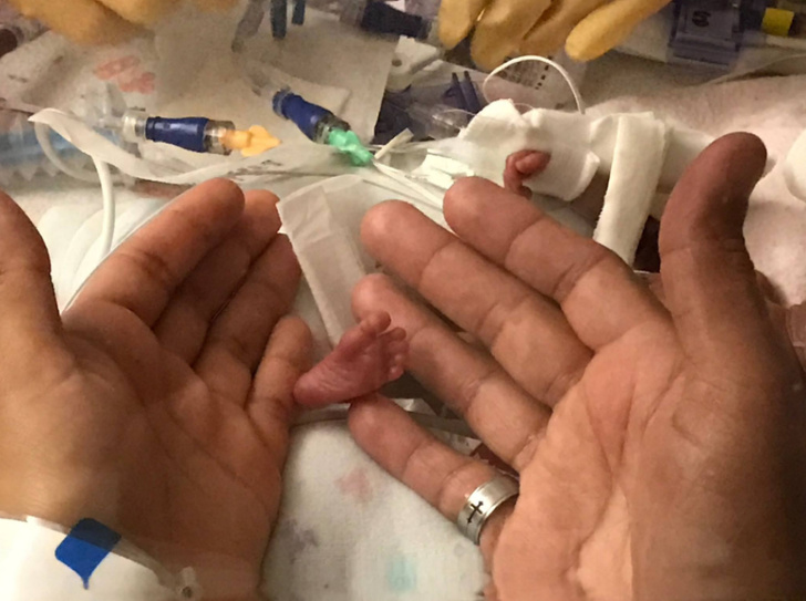 Illustration de l'article : Ces 15 photos qui racontent une histoire sensible