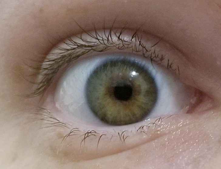 Illustration de l'article : Ces 18 personnes sont uniques grâce à leurs particularités physiques