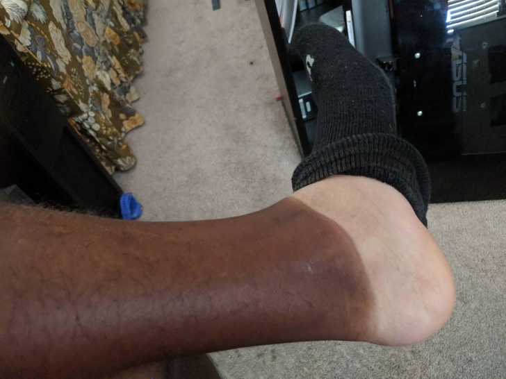 Illustration de l'article : Ces 17 solutions aux problèmes quotidiens qui laissent à désirer