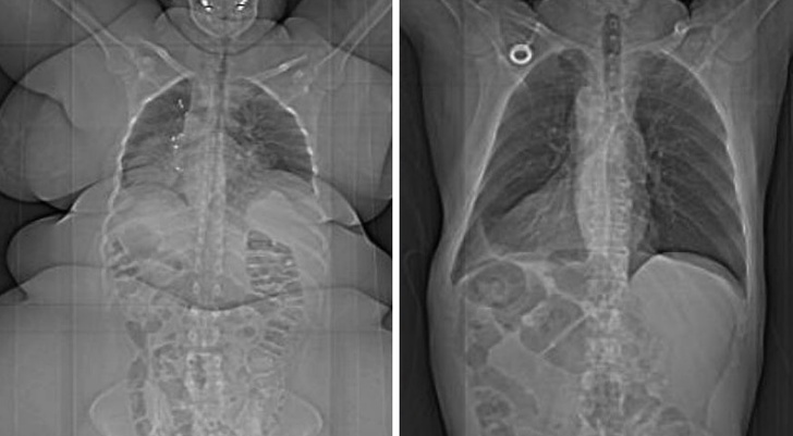 Illustration de l'article : Ces 15 photos qui en disent beaucoup sur le corps humain