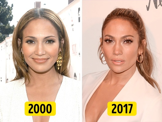 Illustration de l'article : 16 changements physiques de stars en 20 ans !