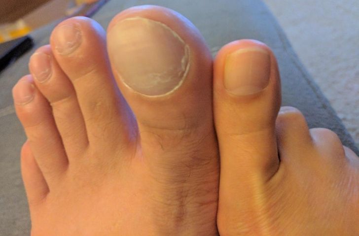 Illustration de l'article : Ces 14 photos comparatives de choses originales