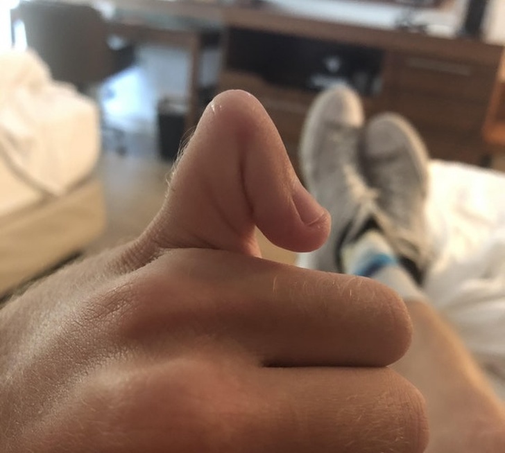 Illustration de l'article : Ces 18 personnes sont uniques grâce à leurs particularités physiques