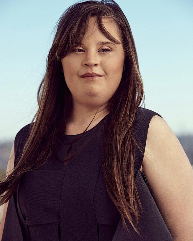 Illustration de l'article : 10 c&eacute;l&eacute;brit&eacute;s qui se sont servies de leurs d&eacute;fauts physiques pour percer