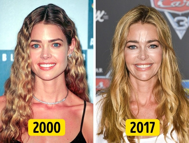 Illustration de l'article : 16 changements physiques de stars en 20 ans !