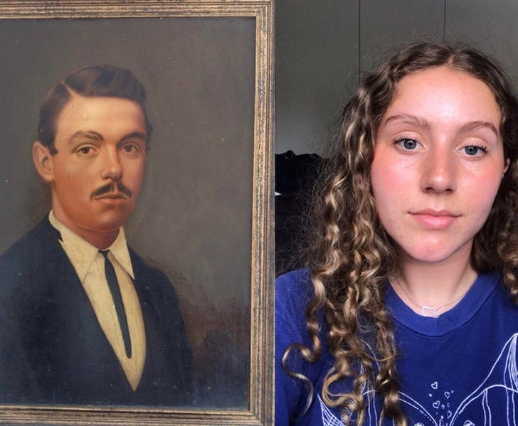 Illustration de l'article : Ces 15 personnes nées avec des signes distinctifs