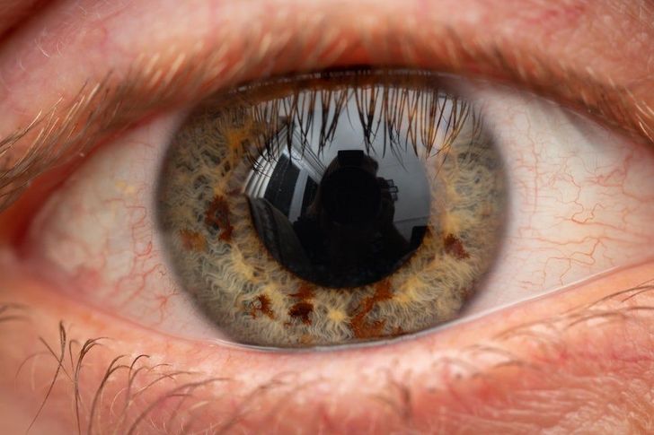 Illustration de l'article : Ces 20 personnes qui ont des traits physiques qui les rendent uniques