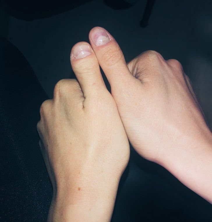 Illustration de l'article : Ces 20 personnes qui ont des traits physiques qui les rendent uniques