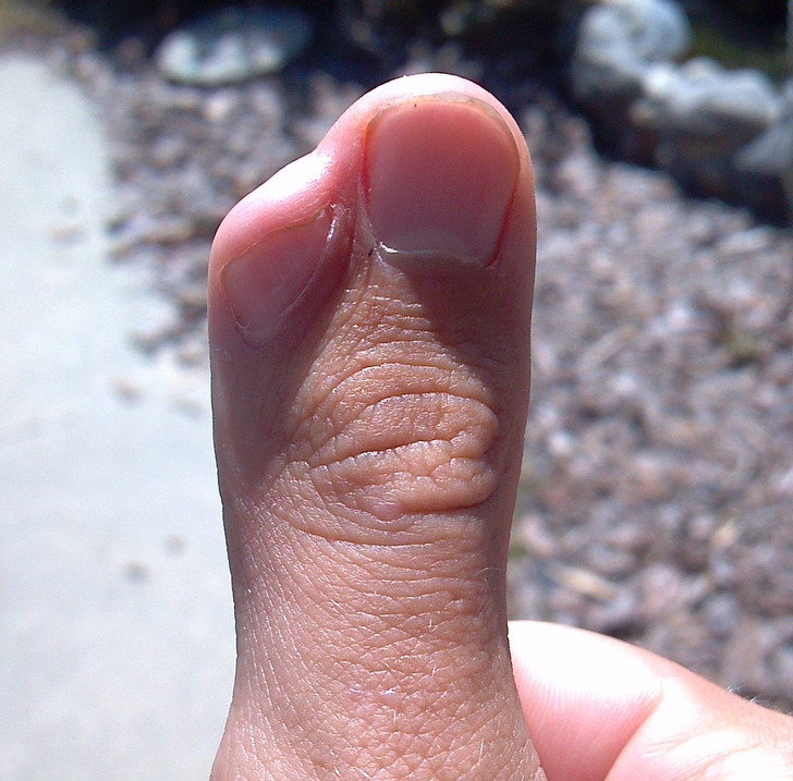 Illustration de l'article : Ces 18 photos de particularités trouvées chez l'homme et dans la nature