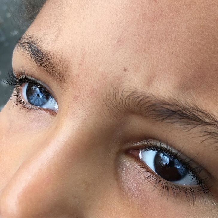 Illustration de l'article : Ces 17 particularités physiques de ces personnes à découvrir