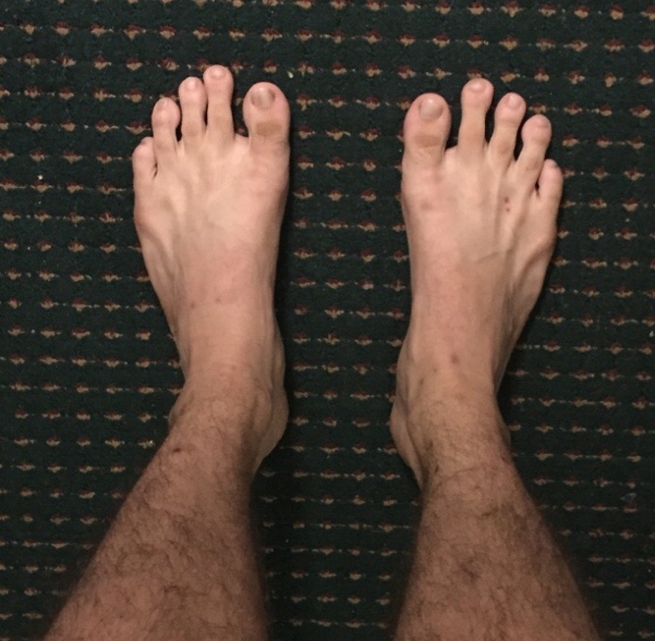 Illustration de l'article : Ces 17 particularités physiques de ces personnes à découvrir