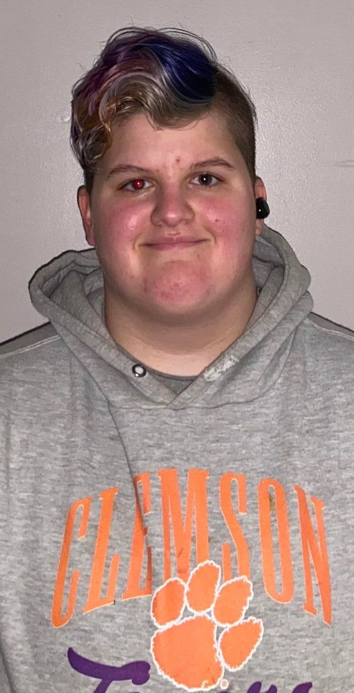 Illustration de l'article : Ces 20 personnes qui ont des traits physiques qui les rendent uniques