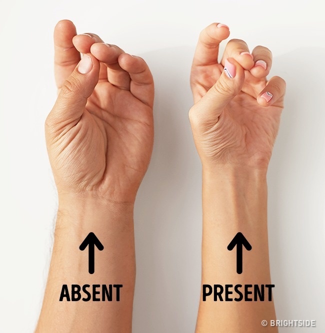 Illustration de l'article : 11 d&eacute;tails sur votre corps qui prouvent que vous &ecirc;tes unique