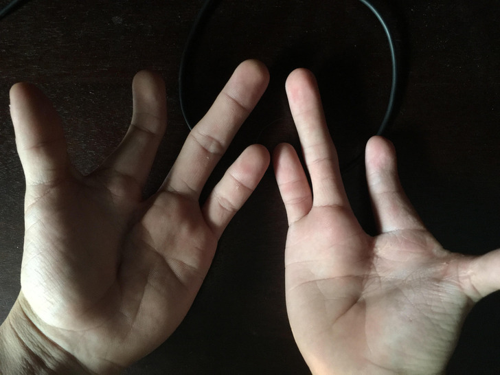 Illustration de l'article : Ces 18 photos de particularités trouvées chez l'homme et dans la nature