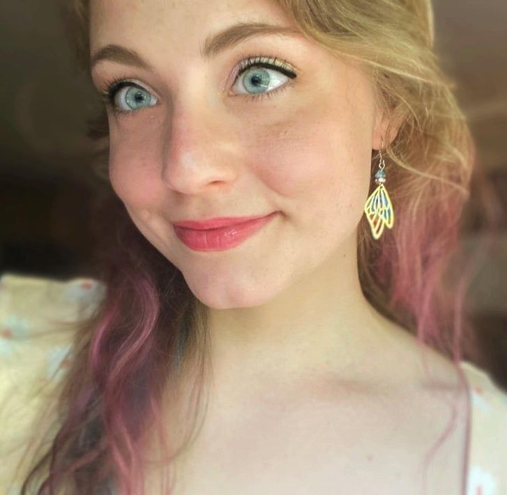 Illustration de l'article : Ces 20 personnes nées avec des particularités offertes par la nature