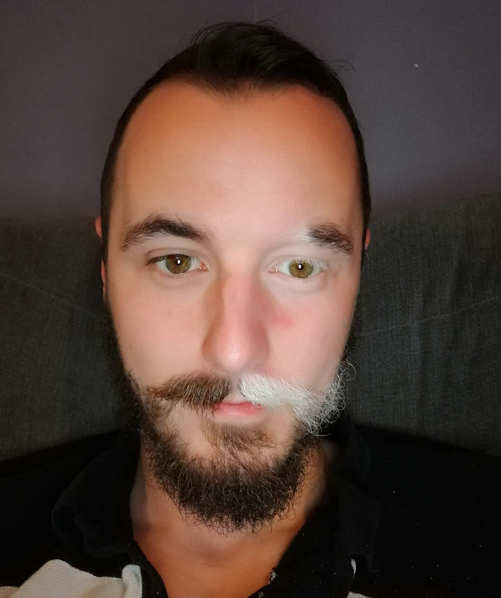 Illustration de l'article : Ces 15 personnes qui ont quelque chose d'unique