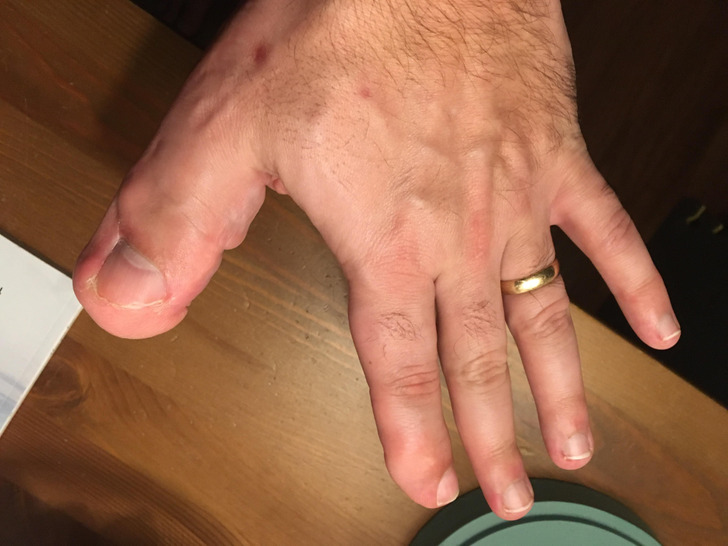 Illustration de l'article : Ces 18 photos de particularités trouvées chez l'homme et dans la nature