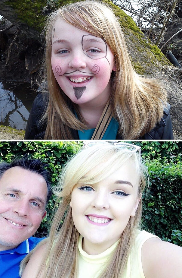 Illustration de l'article : 115 photos avant/après qui prouvent l’efficacité des appareils dentaires 