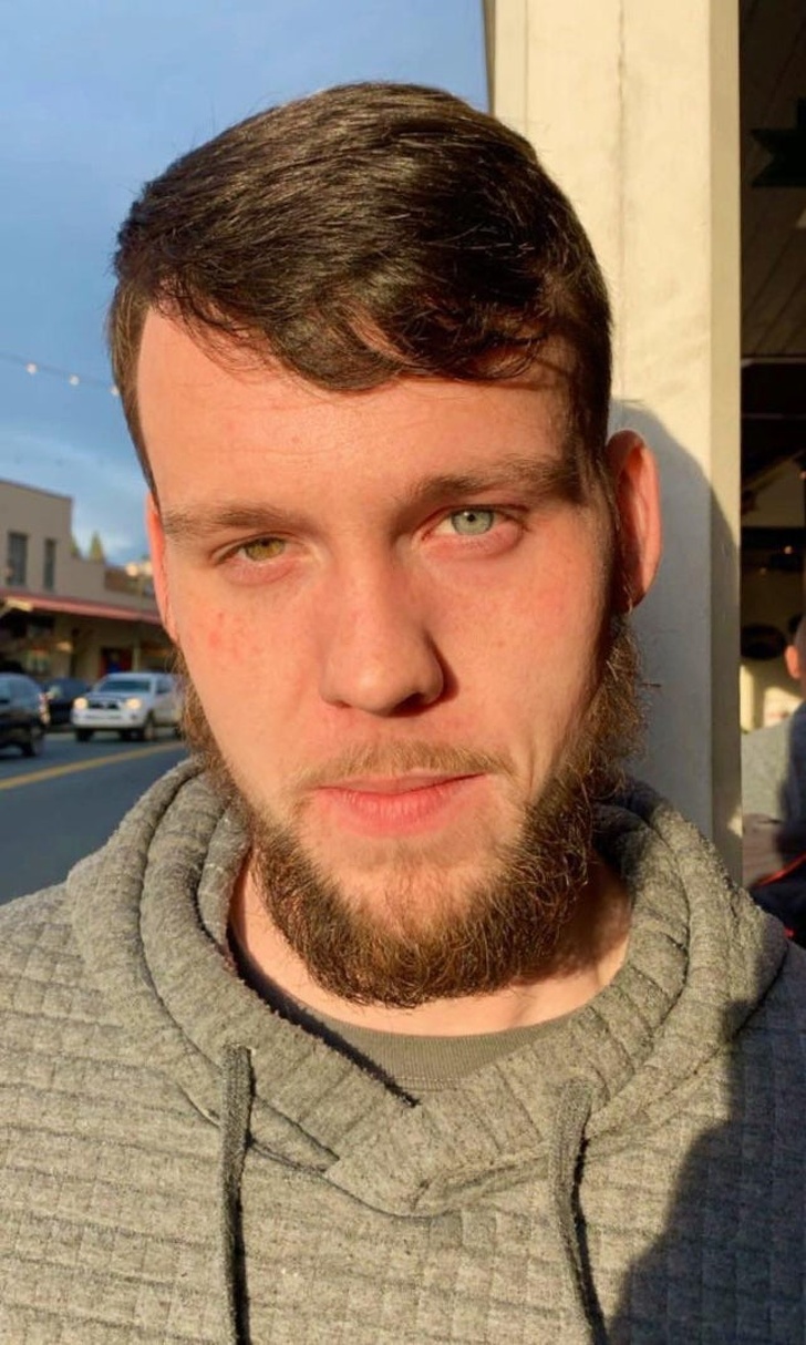 Illustration de l'article : Ces 15 personnes nées avec des signes distinctifs