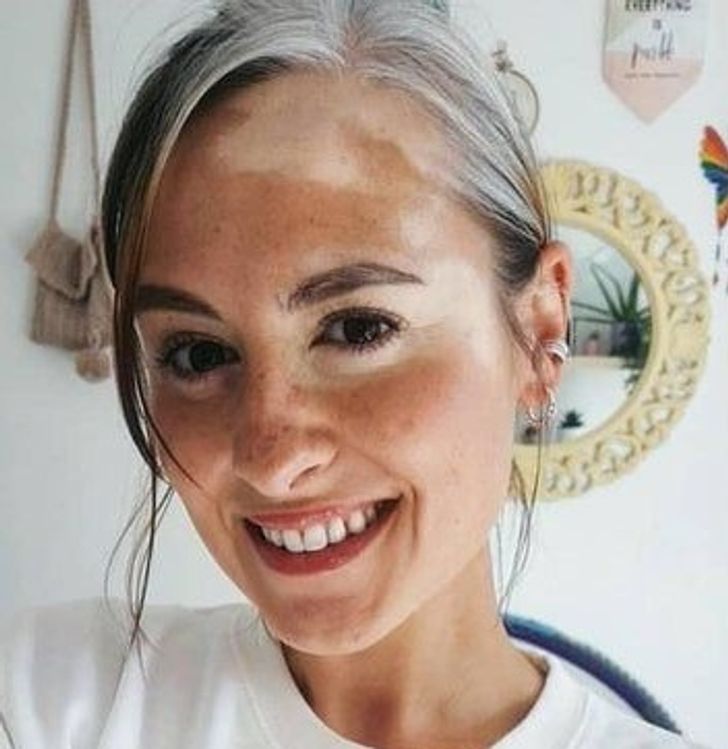 Illustration de l'article : Ces 20 personnes nées avec des particularités offertes par la nature