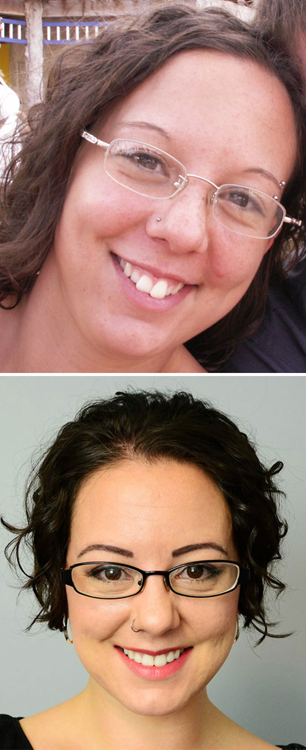 Illustration de l'article : 115 photos avant/après qui prouvent l’efficacité des appareils dentaires 