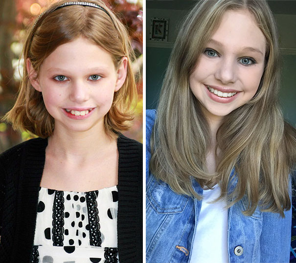 Illustration de l'article : 115 photos avant/après qui prouvent l’efficacité des appareils dentaires 