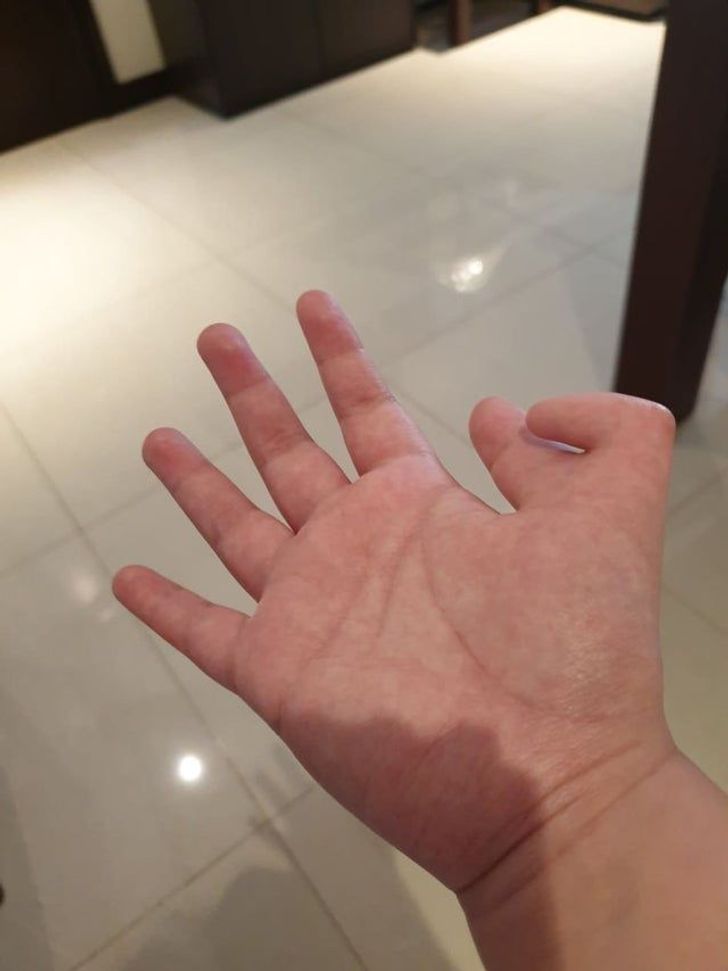 Illustration de l'article : Ces 20 personnes qui ont des traits physiques qui les rendent uniques