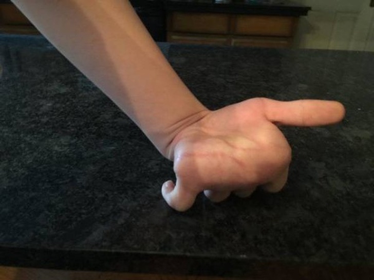 Illustration de l'article : Ces 15 personnes qui ont quelque chose d'unique