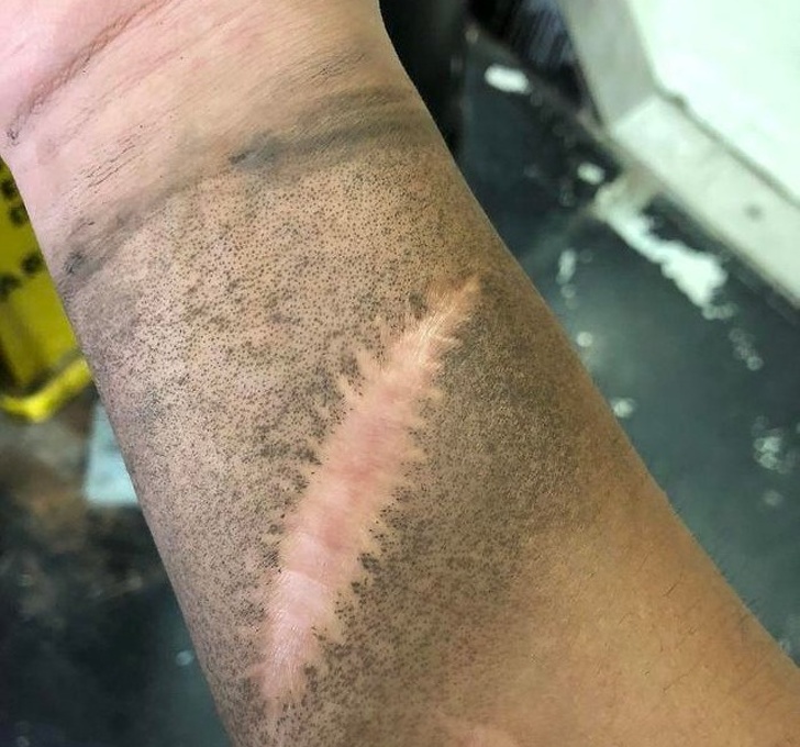 Illustration de l'article : Ces 15 photos qui en disent beaucoup sur le corps humain