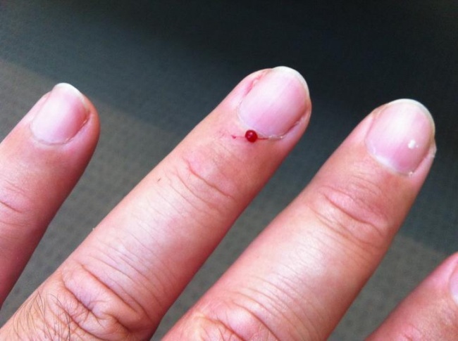 Illustration de l'article : 22 choses qui tapent vraiment sur les nerfs