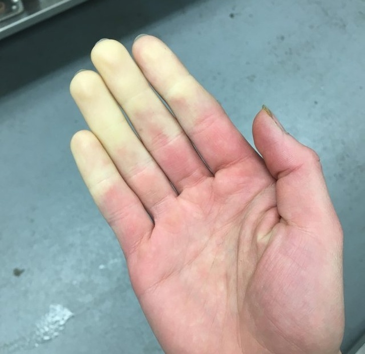 Illustration de l'article : Ces 15 personnes qui ont quelque chose d'unique