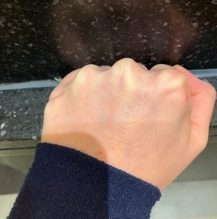 Illustration de l'article : Ces 20 personnes nées avec des particularités offertes par la nature