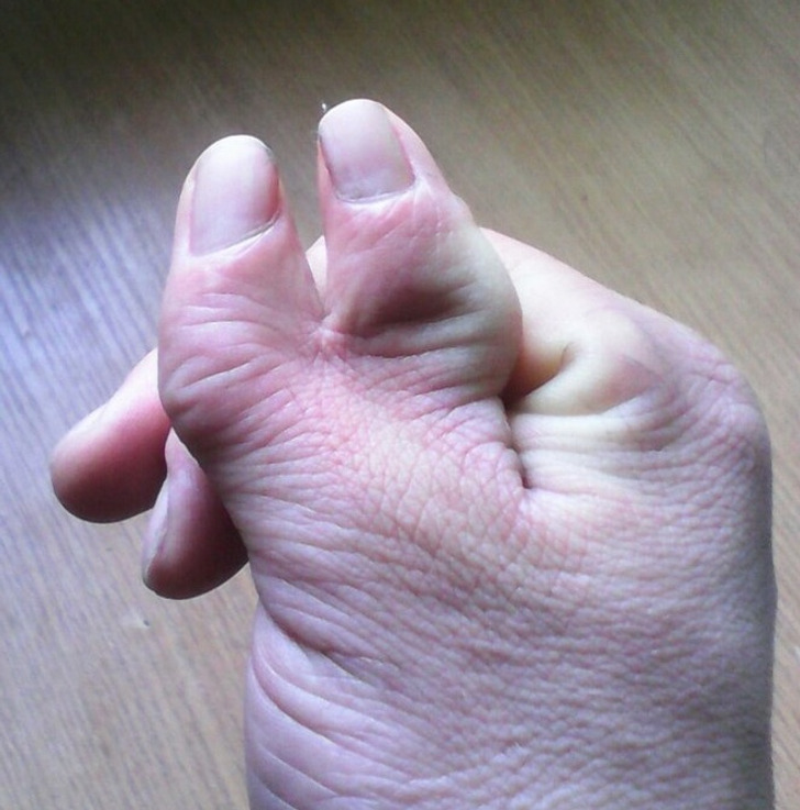 Illustration de l'article : Ces 18 photos de particularités trouvées chez l'homme et dans la nature