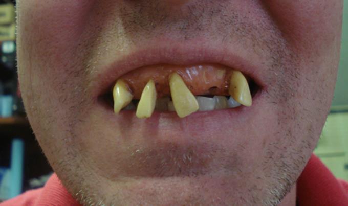 Illustration de l'article : 12 inventeurs devenus riches après avoir créé des choses inutiles