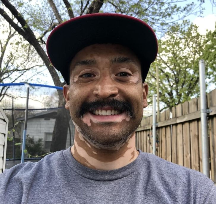 Illustration de l'article : Ces 17 personnes qui ont des traits physiques uniques